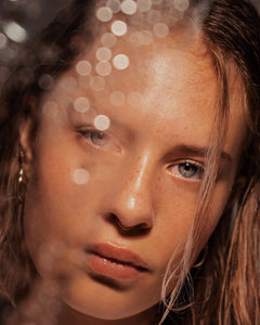 The Ultimate Guide For Hyperpigmentation